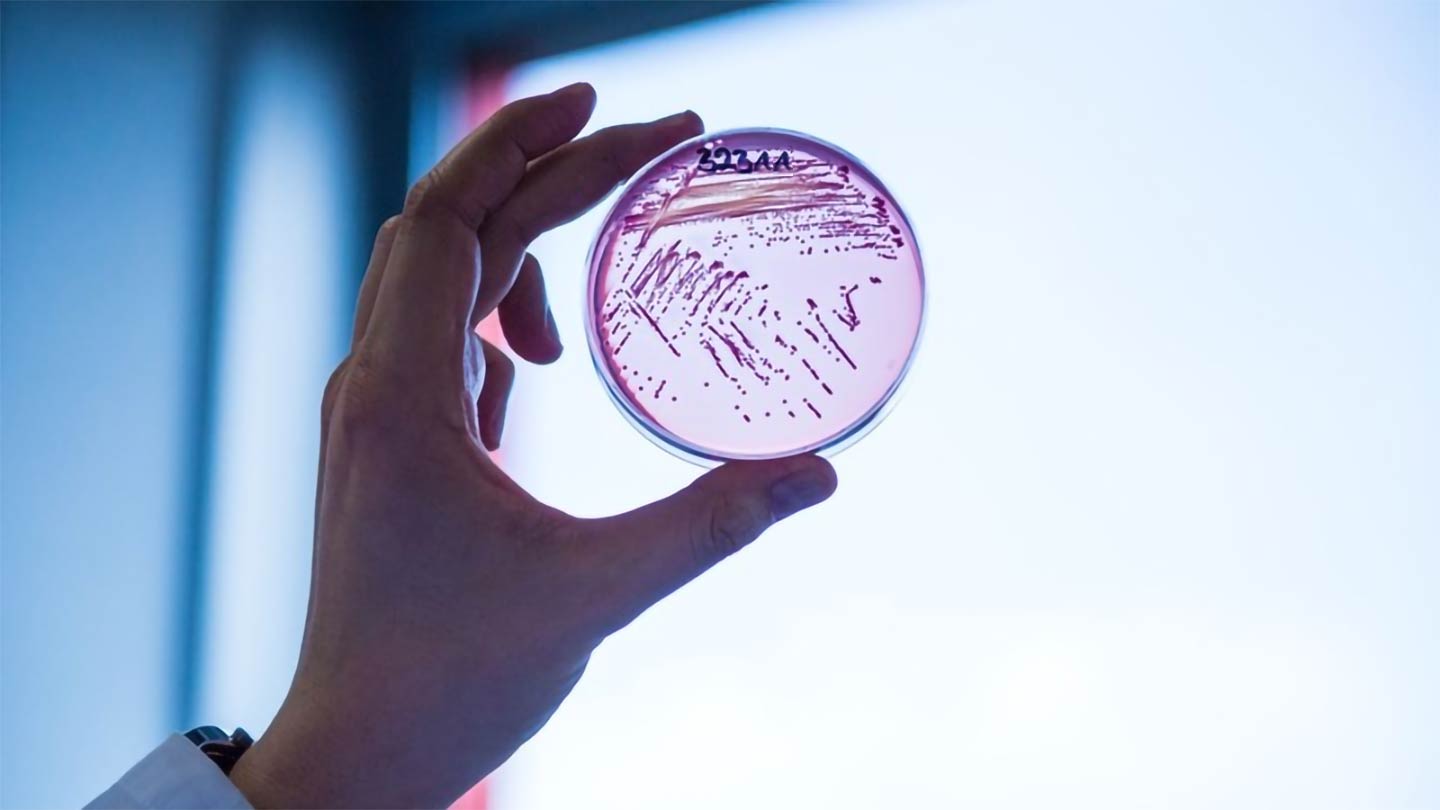  Escherichia coli being handled by a scientist | Machine Learning Department at Carnegie Mellon University